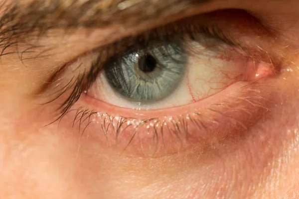 Ojo Del Hombre Gris Azul Con Venas Rojas Muy Cerca — Foto de Stock