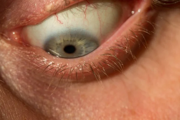 Mans Eye Gray Blue Red Veins Very Close — Stock Photo, Image