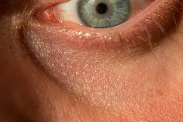 Ojo Del Hombre Gris Azul Con Venas Rojas Muy Cerca — Foto de Stock