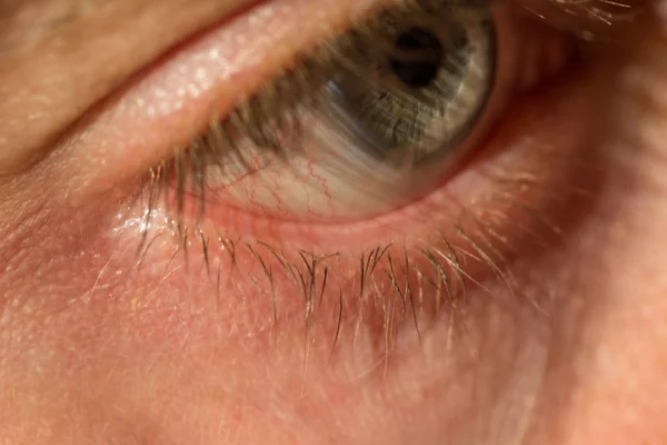 Ojo Del Hombre Gris Azul Con Venas Rojas Muy Cerca — Foto de Stock