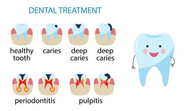 Diş hastalıkları. Caries, pulpitis, periodontitis. Vektör illüstrasyonu