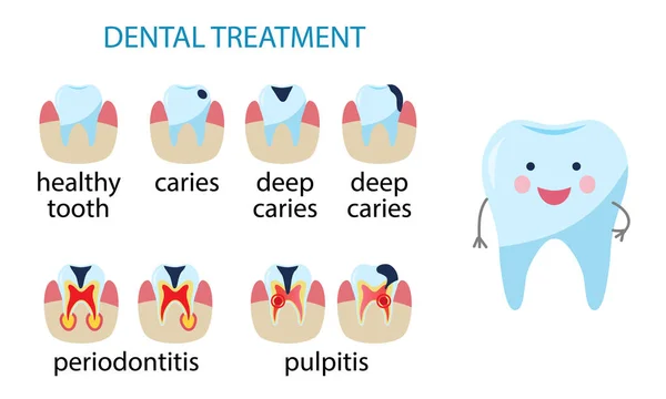 A fogak betegségei. fogszuvasodás, pulpitis, periodontitis. Vektorillusztráció — Stock Vector