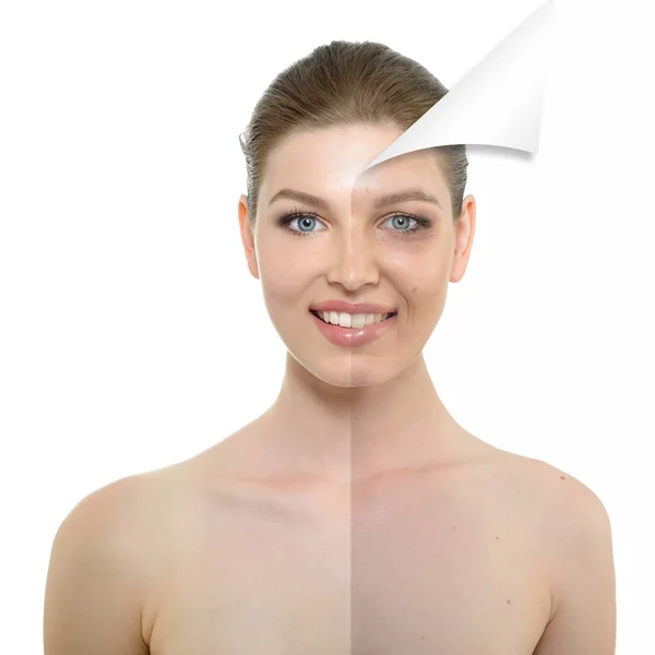 Problem and clean skin — Stock Photo, Image