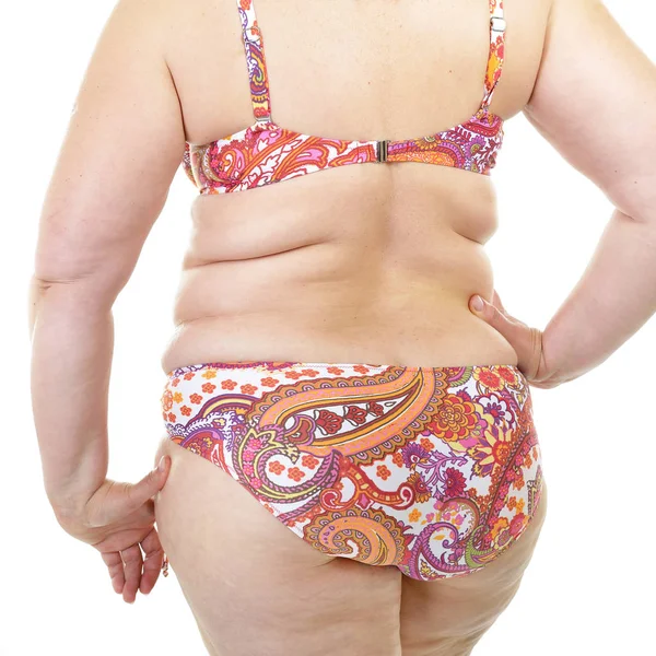 Kobieta z nadwagą cellulitis — Zdjęcie stockowe