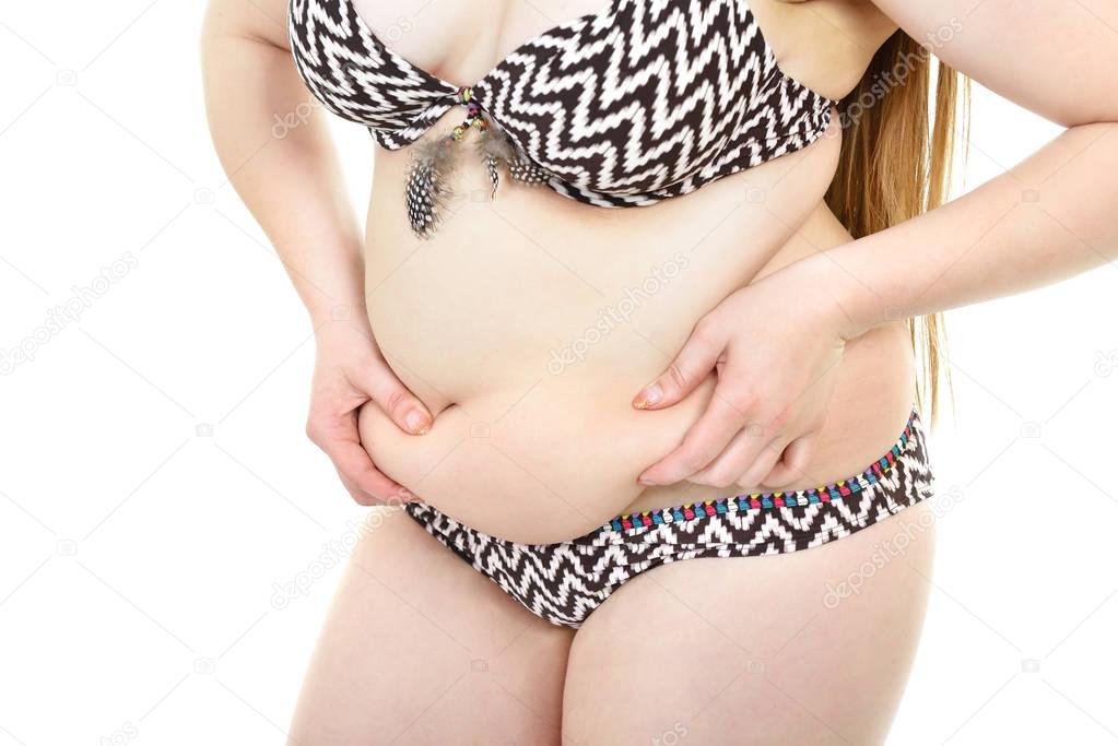 Overweight cellulitis woman