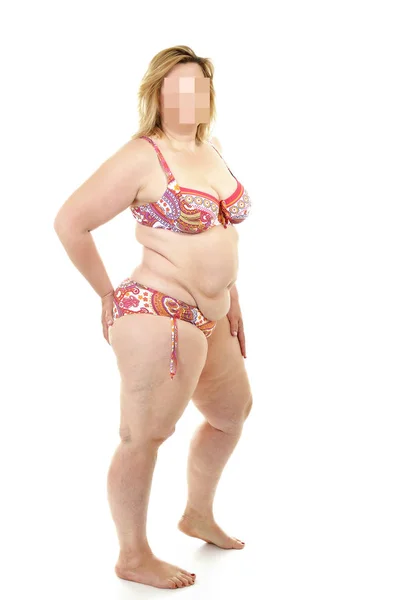 Надмірна вага, целюліт жінка — стокове фото