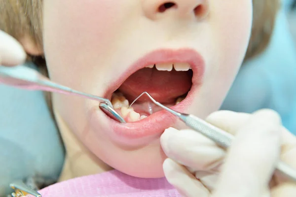 Dentysta utwardzania pacjenta — Zdjęcie stockowe