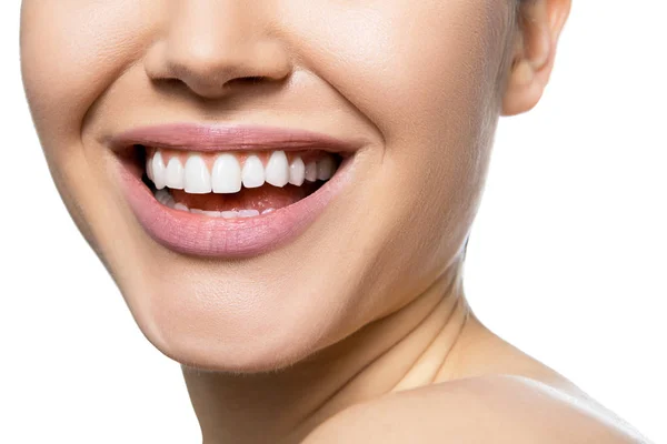Lachende Frauenmund mit großen Zähnen vor weißem Hintergrund. hea — Stockfoto