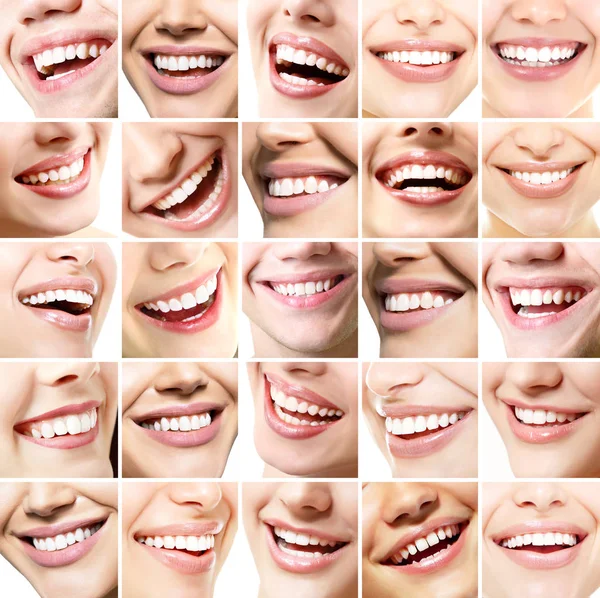 Glimlacht instellen. Perfecte brede glimlach van jonge verse vrouwen en mannen-wit — Stockfoto