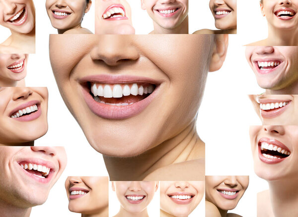 Laughing women and man with great teeth over white background. Healthy beautiful male and female smile. Teeth health, whitening, prosthetics and care. Set of perfect smiles. Happy people, detail.