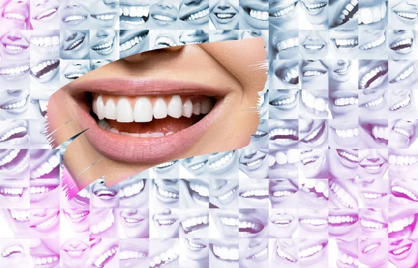 Konceptuální Pozadí Tvoří Soubor Rozesmátých Lidských Tváří Velkými Zuby Detailem — Stock fotografie