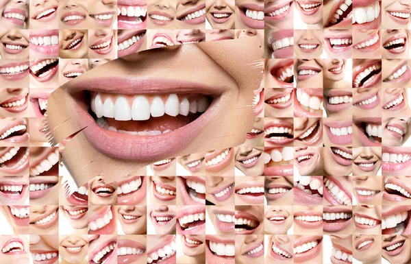 概念背景是一组笑着的人的脸 有着巨大的牙齿和年轻女人美丽的微笑的细节 健康美丽的男男女女笑着 牙齿健康 假肢和护理 一套完美的微笑 快乐的人 — 图库照片