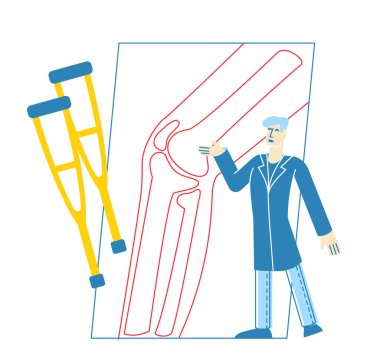 Küçük Doktor Cüppeli Ortopedi Üniformalı Ortopedi Uzmanı, Diz Eklemli Dev X-ray Resmini Gösteriyor. Sağlık, Hastane, Klinik, Randevu Hekimliği Uzmanı. Doğrusal Vektör İllüstrasyonu