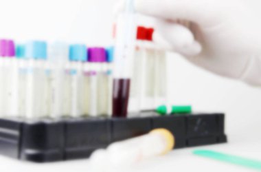 Coronavirus hastalığının bulanık görüntüsü (Covid-19). Coronavirus hastalığı (Covid-19) daha önce insanlarda tespit edilmemiş yeni bir virüsün yol açtığı bulaşıcı bir hastalıktır..