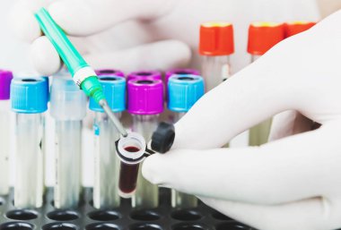 Coronavirus hastalığı görüntüsü (Covid-19). Coronavirus hastalığı (Covid-19) daha önce insanlarda tespit edilmemiş yeni bir virüsün yol açtığı bulaşıcı bir hastalıktır..