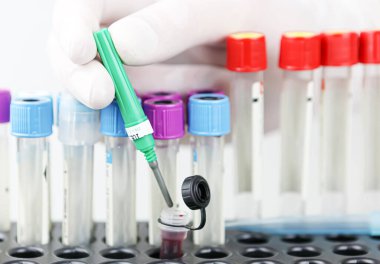 Coronavirus hastalığı görüntüsü (Covid-19). Coronavirus hastalığı (Covid-19) daha önce insanlarda tespit edilmemiş yeni bir virüsün yol açtığı bulaşıcı bir hastalıktır..