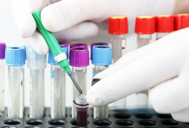 Coronavirus hastalığı görüntüsü (Covid-19). Coronavirus hastalığı (Covid-19) daha önce insanlarda tespit edilmemiş yeni bir virüsün yol açtığı bulaşıcı bir hastalıktır..