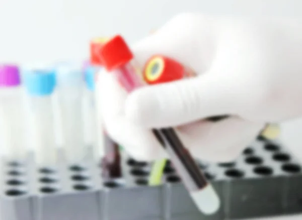 2019 Ncov Laboratoriumtests Vermoedelijke Infectie Bij Mens Coronavirusziekte Covid Een — Stockfoto