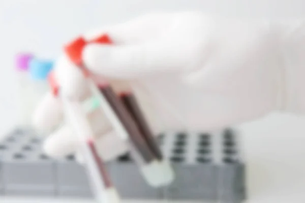2019 Ncov Laboratuvar Testinde Insan Enfeksiyonu Şüphesi Var Coronavirus Hastalığı — Stok fotoğraf