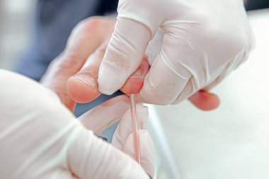 Kan testi, genellikle koldaki bir damardan deri altı iğnesiyle ya da parmak iğnesiyle alınan bir kan örneği üzerinde yapılan bir laboratuvar analizidir. Modern hastane hematoloji laboratuvarı.
