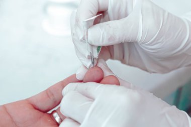 Kan testi, genellikle koldaki bir damardan deri altı iğnesiyle ya da parmak iğnesiyle alınan bir kan örneği üzerinde yapılan bir laboratuvar analizidir. Modern hastane hematoloji laboratuvarı.
