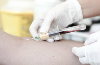Kan testi, genellikle koldaki bir damardan deri altı iğnesiyle ya da parmak iğnesiyle alınan bir kan örneği üzerinde yapılan bir laboratuvar analizidir. Modern hastane hematoloji laboratuvarı.