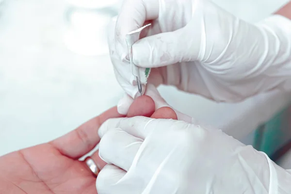 血液检测是对血样进行的实验室分析 血样通常使用皮下注射针或通过指刺从手臂静脉中提取 现代医院血液学实验室 — 图库照片