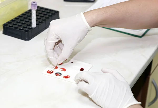 Wetenschapper Werkt Zijn Laboratorium Een Bloedonderzoek Een Laboratoriumanalyse Uitgevoerd Een — Stockfoto