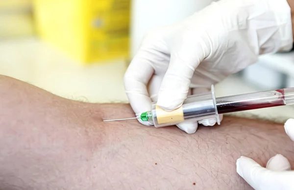 血液检测是对血样进行的实验室分析 血样通常使用皮下注射针或通过指刺从手臂静脉中提取 现代医院血液学实验室 — 图库照片