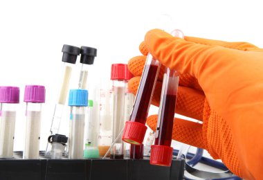 Coronavirus hastalığı (COVID-19) araştırması. Kan testi. Düzenli kan testi genel fiziksel sağlığınızı korumanın en önemli yollarından biridir..