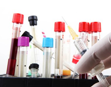 Bağışıklık ve aşı. Aşılar, 25 'ten fazla zayıflatıcı veya hayati tehlikesi olan hastalığa karşı korur. Coronavirus aşısı testi.