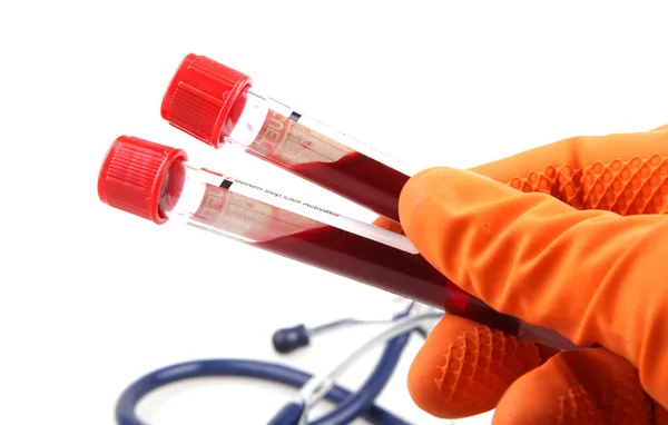 ブルガリアのブルガス 2013年2月3日 研究室で働く科学者 血液検査 定期的な血液検査は 身体全体の健康を追跡するための最も重要な方法の1つです — ストック写真