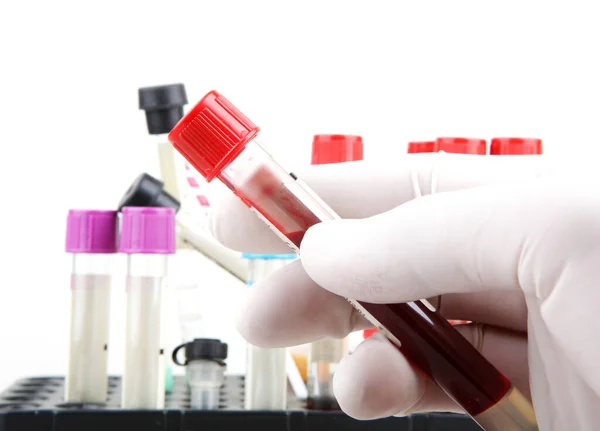 Исследование Коронавирусной Болезни Covid Анализ Крови Регулярный Анализ Крови Является — стоковое фото