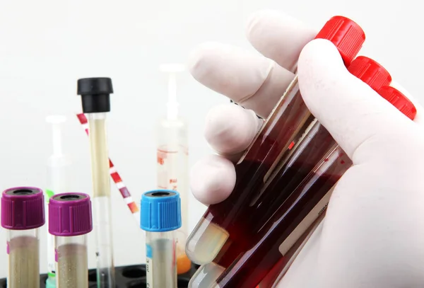 Coronavirus Disease Covid Research Blood Test Regular Blood Testing One — 스톡 사진