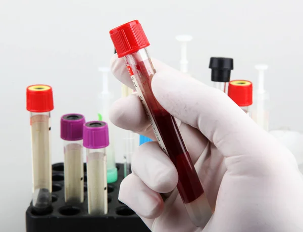 Burgaz Bulgaristan Şubat 2013 Laboratuvarında Çalışan Bilim Adamı Kan Testi — Stok fotoğraf