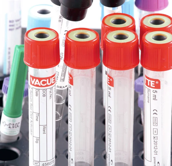 ブルガリアのブルガス 2010年9月24日 病院の実験室で使用される機器 検査血液検査 — ストック写真