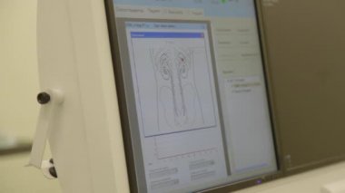 Ameliyathane lithotriptor ekran