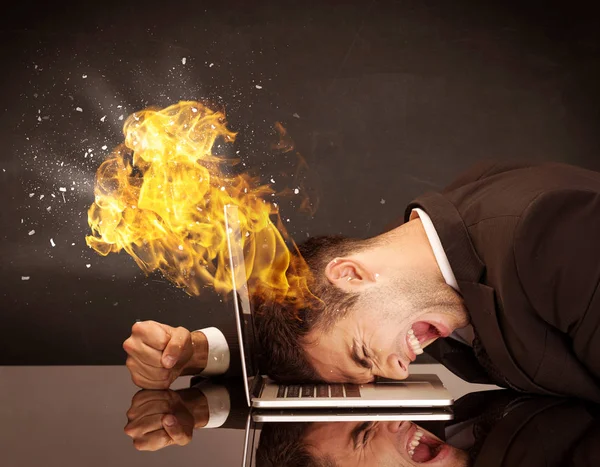 Το κεφάλι του πιεσμένου επιχειρηματία καίγεται. — Φωτογραφία Αρχείου
