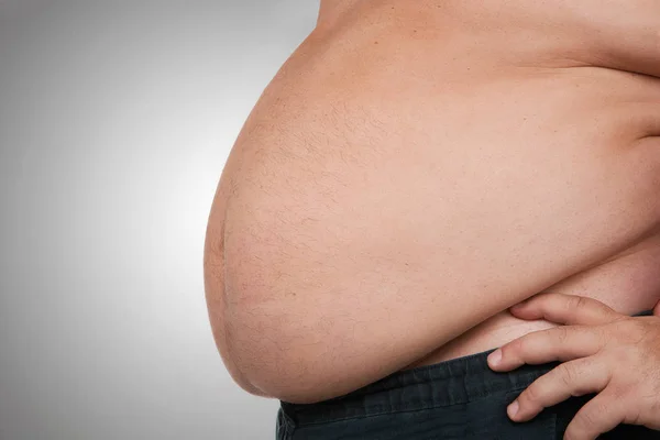 El primer plano del vientre gordo —  Fotos de Stock
