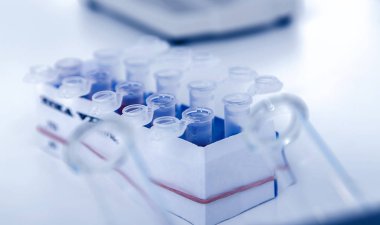 Mikro tüplerini kan örneği Zika virüs ile pozitif