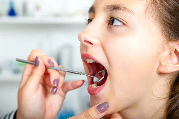 Hastaların yakın çekim oral araştırma grubu tarafından yansıtma sırasında ağız açın. Bayan hasta tedavi diş hekimi — Stok fotoğraf