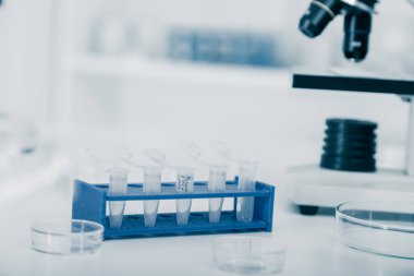 Laboratuvarda bir dizi bilimsel örnek var. Tıbbi kimyasal analiz için test tüpleri..