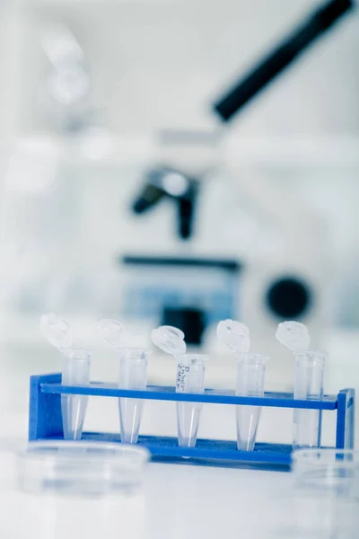 Rząd Rur Próbkami Naukowymi Laboratorium Rurki Badań Medycznych Analiz Chemicznych — Zdjęcie stockowe