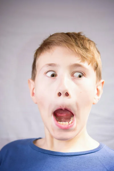 Emotioneel Portret Van Een Jarige Jongen Emotionele Portret Van Verrassing — Stockfoto