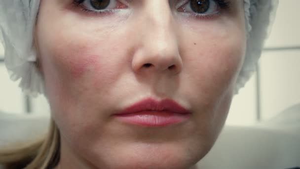 Cosmetólogos manos en guantes haciendo la inyección de envejecimiento facial en una piel femenina . — Vídeos de Stock