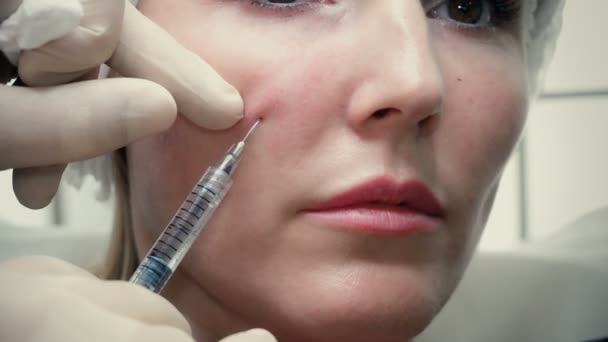 Cosmetologists mãos em luvas que fazem a injeção de envelhecimento de cara em uma pele feminina . — Vídeo de Stock
