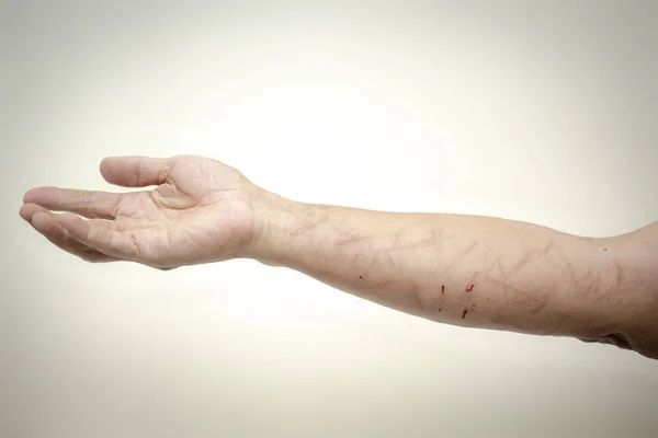 Изображение Поврежденной Руки Листа Походе Защитной Одежды Лицензионные Стоковые Изображения