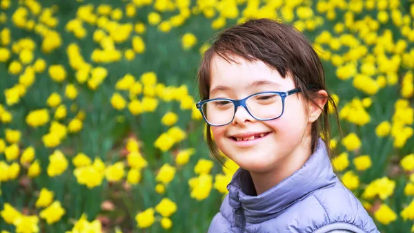 Giù ragazza sindrome su sfondo di campo di fiori — Foto Stock