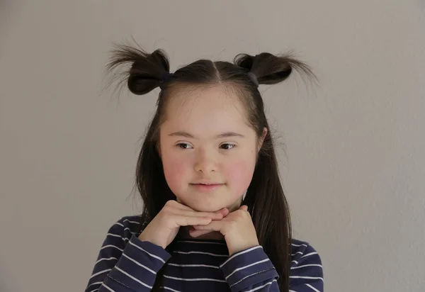 Bonito Sorrindo Para Baixo Menina Síndrome Fundo Cinza — Fotografia de Stock