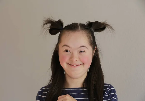 Gri Arka Planda Gülümseyen Sevimli Bir Sendrom Kızı — Stok fotoğraf